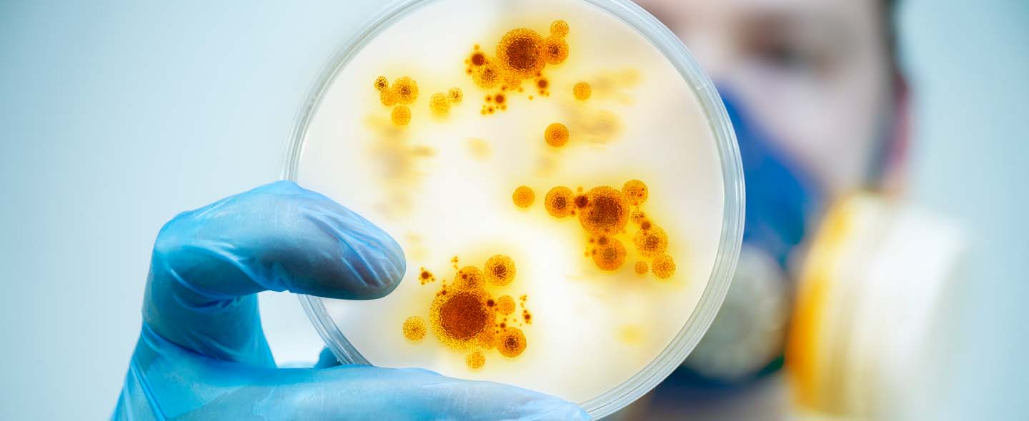 Colonies of bacteria in a culture media plate